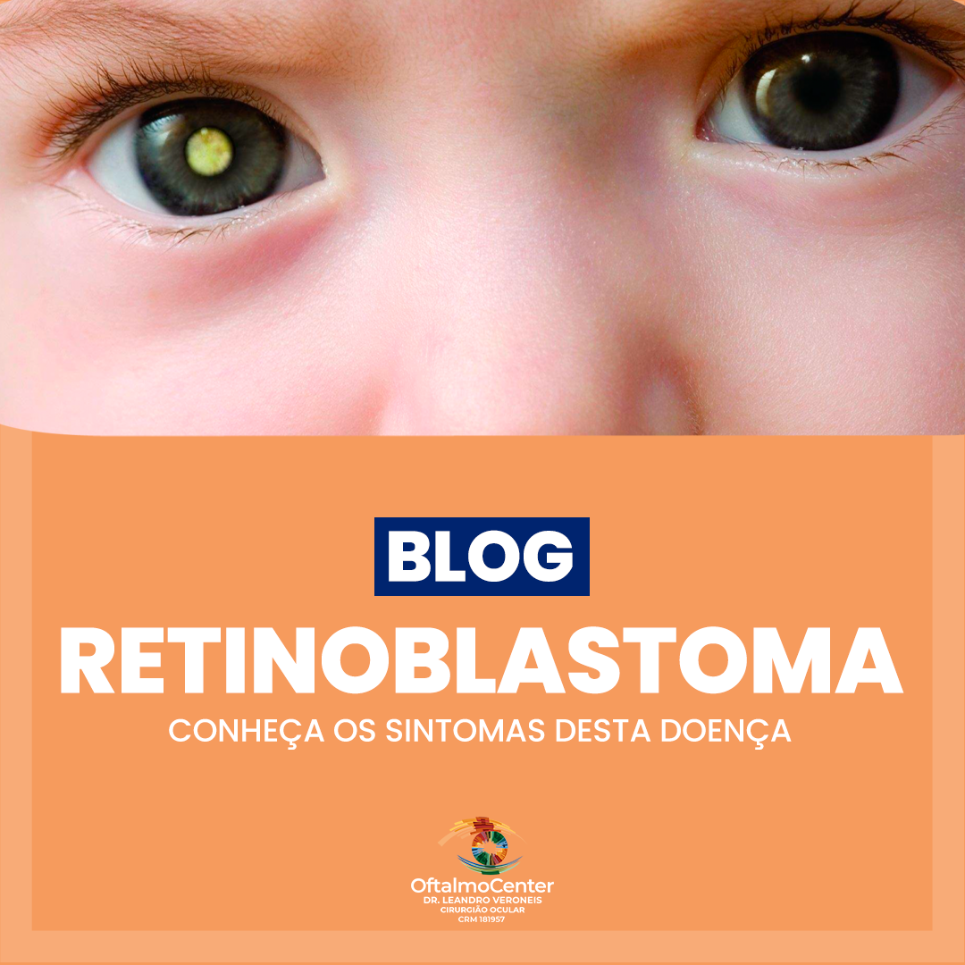 Retinoblastoma: Conheça os Sintomas Dessa Doença