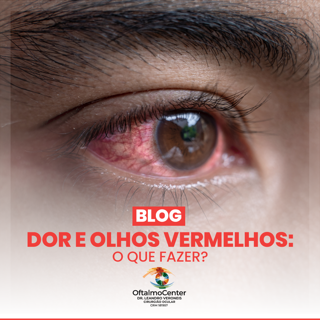 Dor e olhos vermelhos: O que fazer?