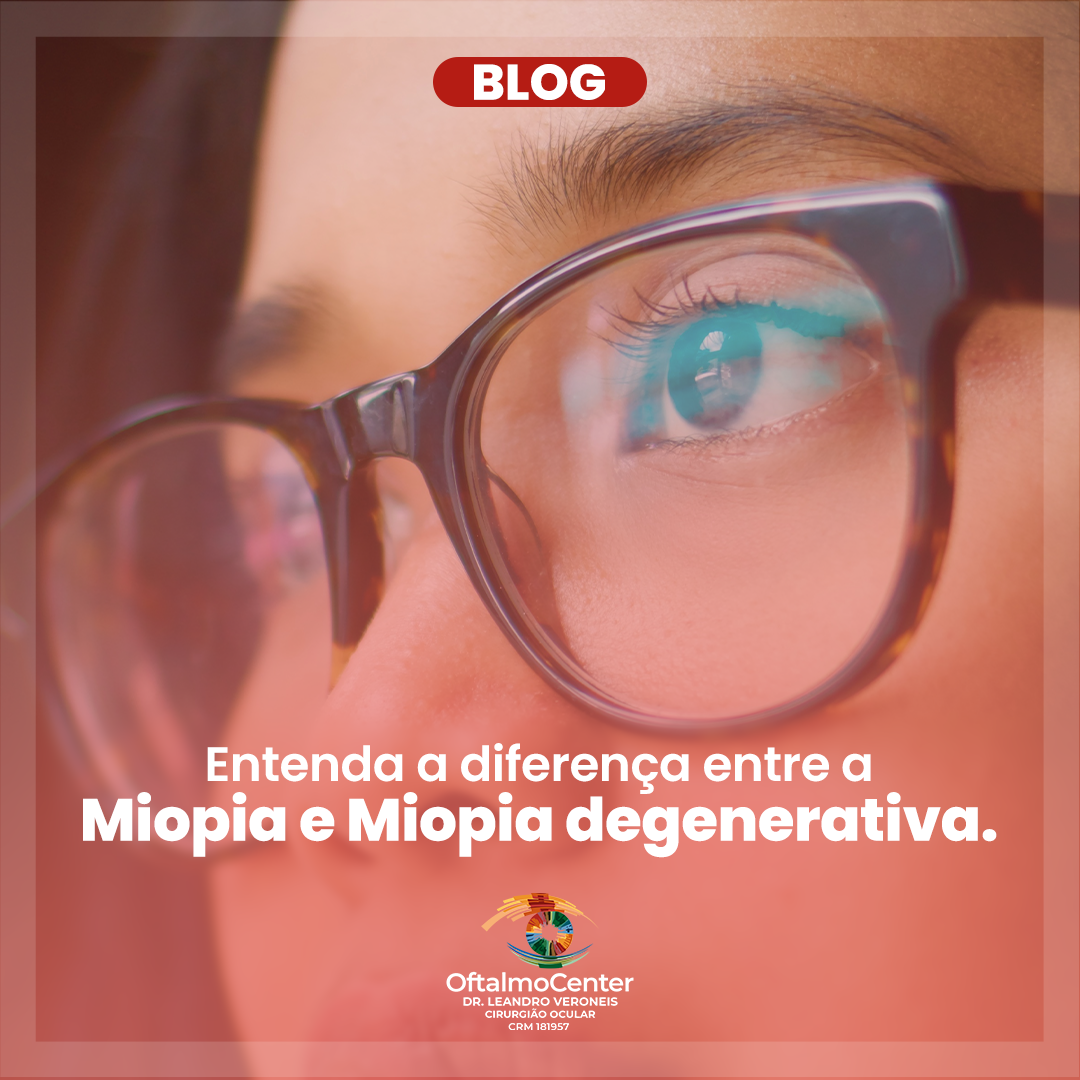 Entenda a diferença entre a miopia e miopia degenerativa