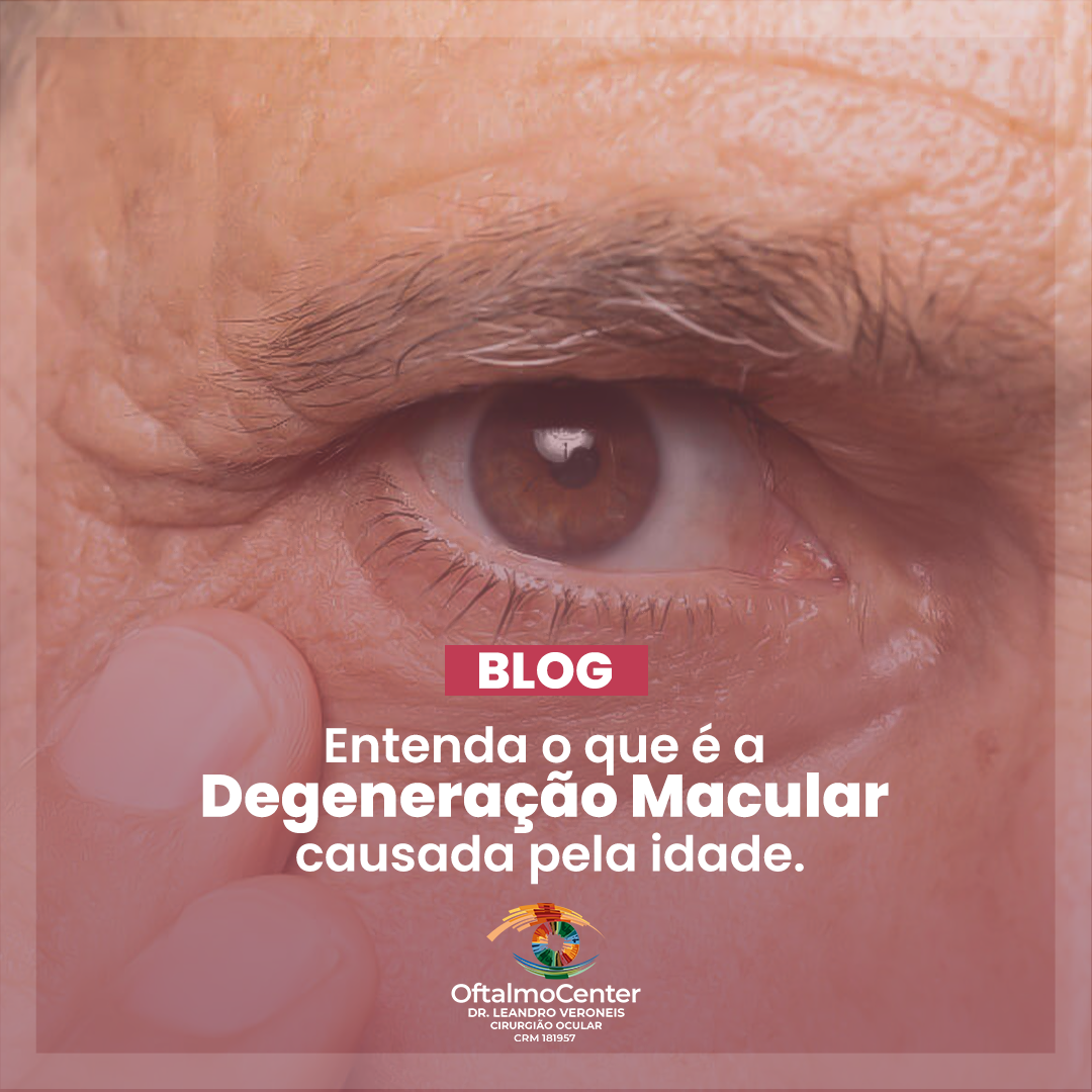 Entenda o que é a Degeneração Macular relacionada a idade