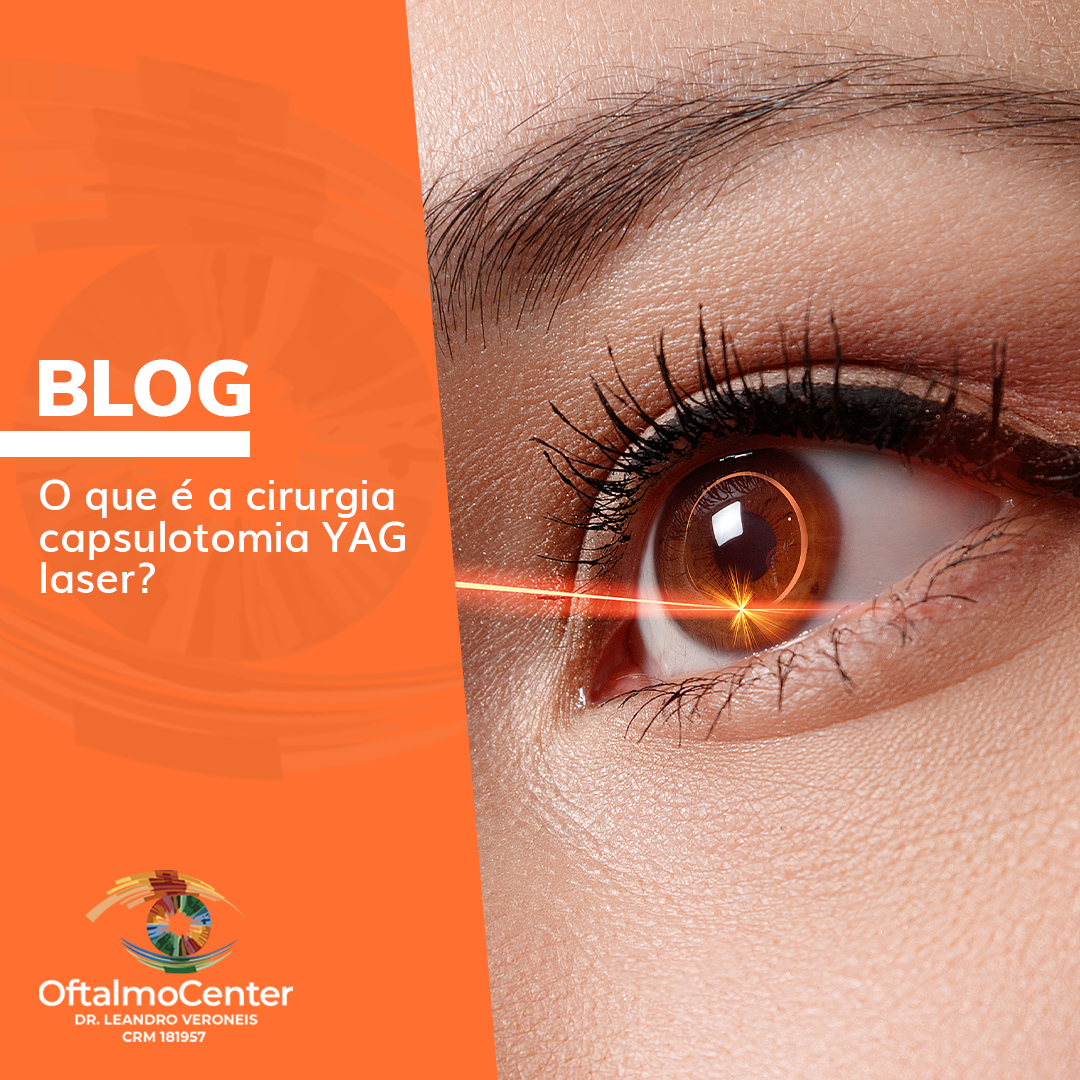 O que é capsulotomia YAG laser?