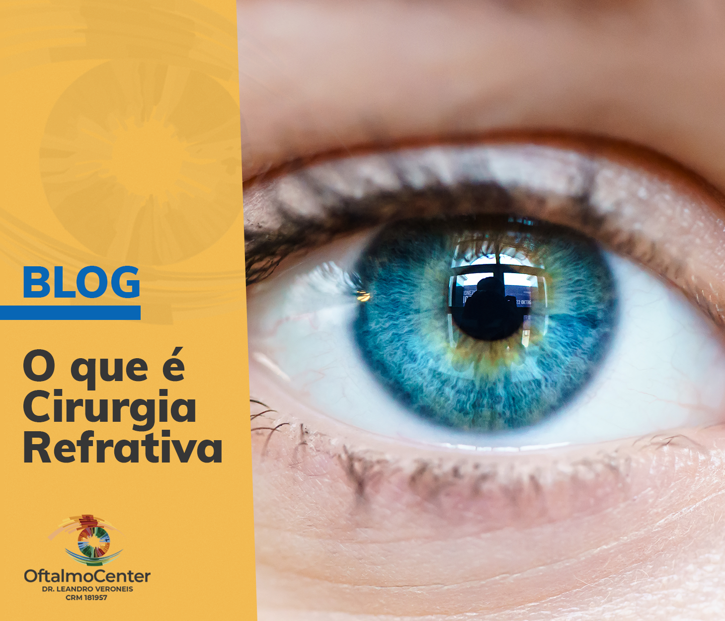 O que é Cirurgia Refrativa