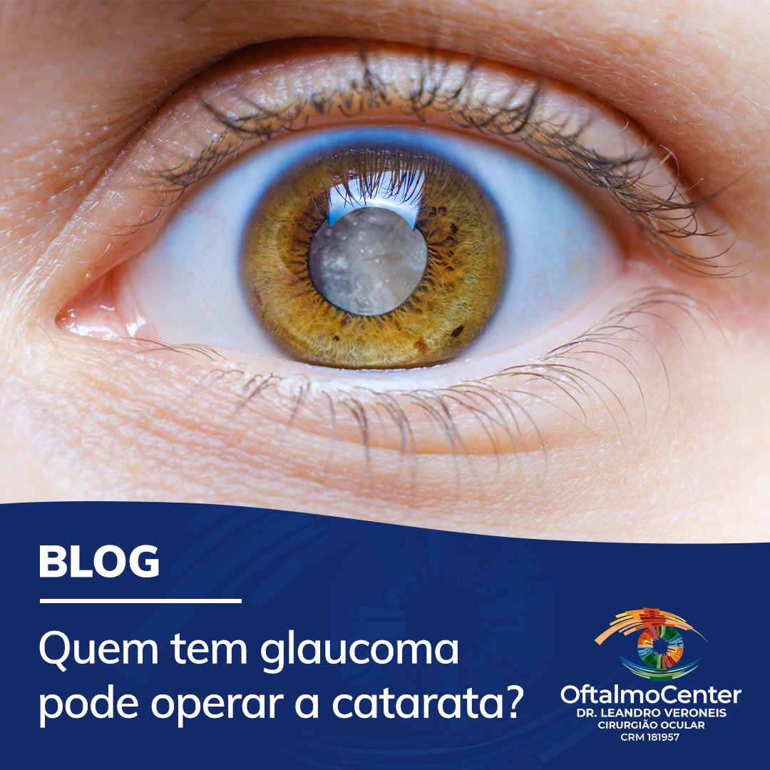 QUEM TEM GLAUCOMA PODE OPERAR A CATARATA?